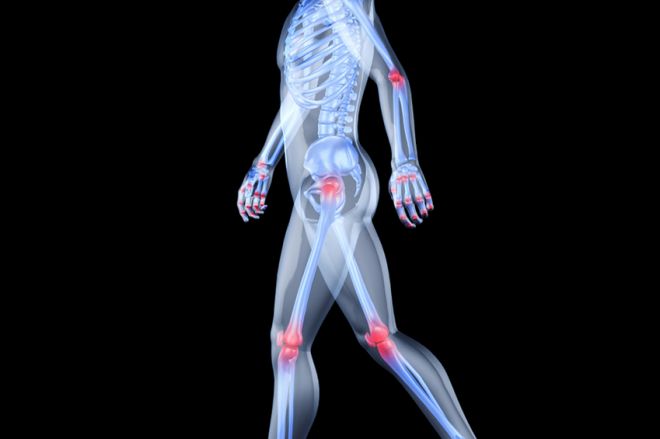mi a különbség az artrózis és a térdízület gonartrózisa között mely orvos kezeli az ízületi fájdalmakat